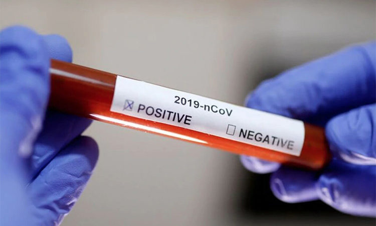 Coronavirus: confirmaron a dos sanfernandinos contagiados en el exterior
