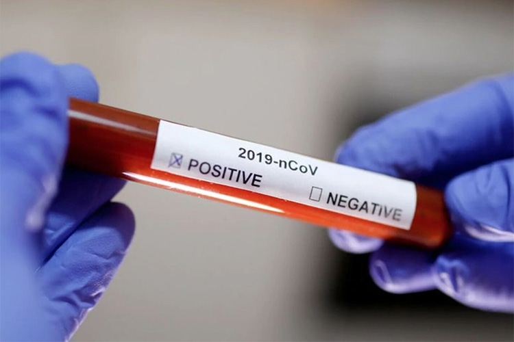 Coronavirus: San Fernando activa protocolo por un nuevo contagio